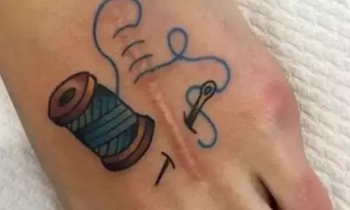 Survival and Strength