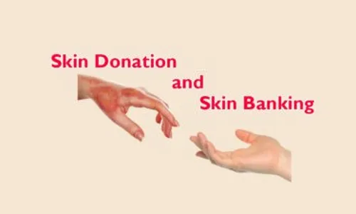 India Needs More Skin Banks For Burns’ Victims