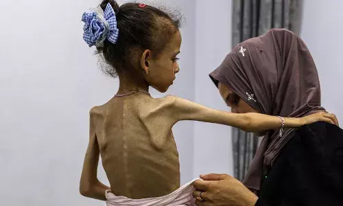 The Weaponization Of Hunger