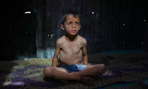 Recognition Without Action Is Meaningless