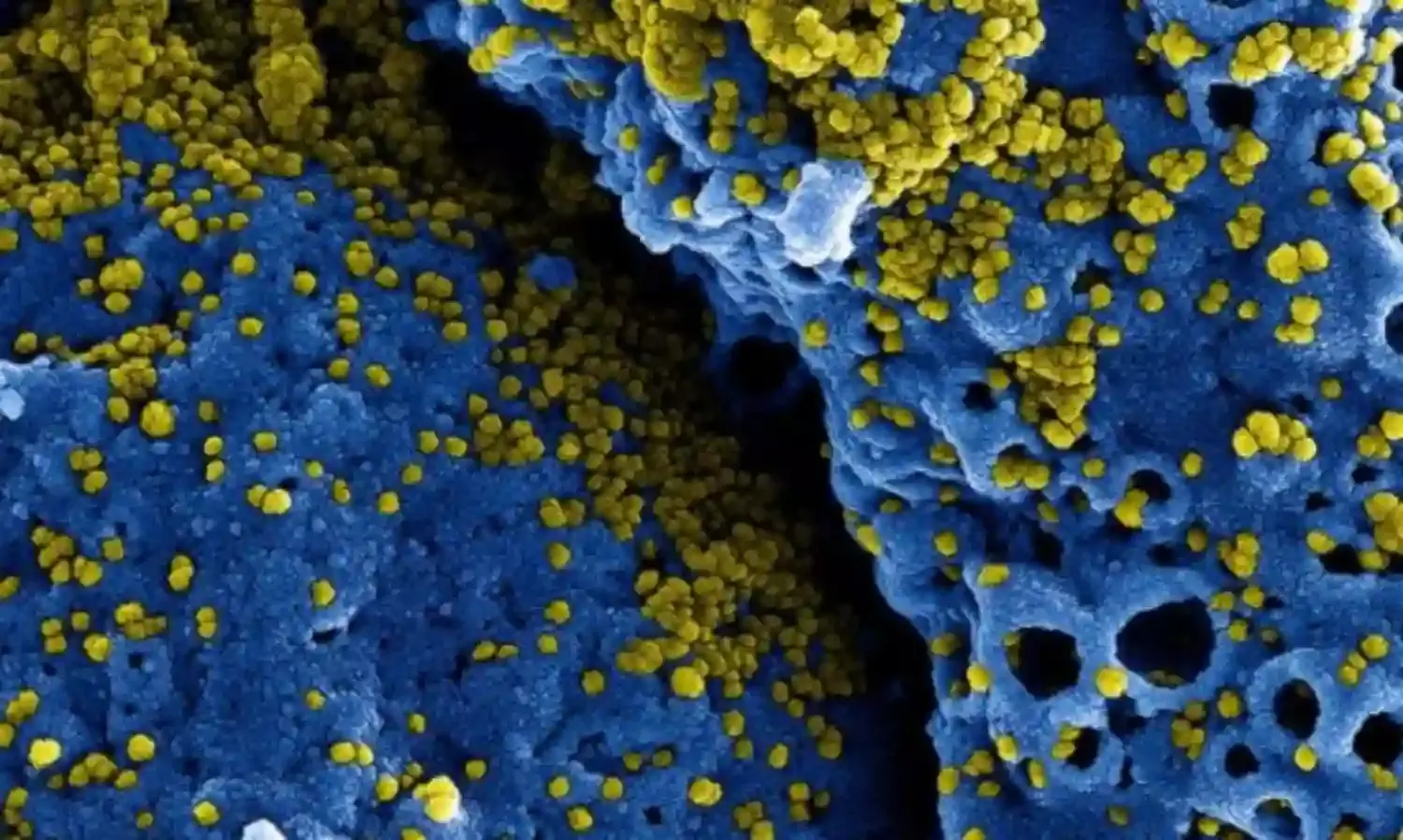 Coronavirus Pandemic Yes, But 10 Reasons Why There Is No Need to Panic