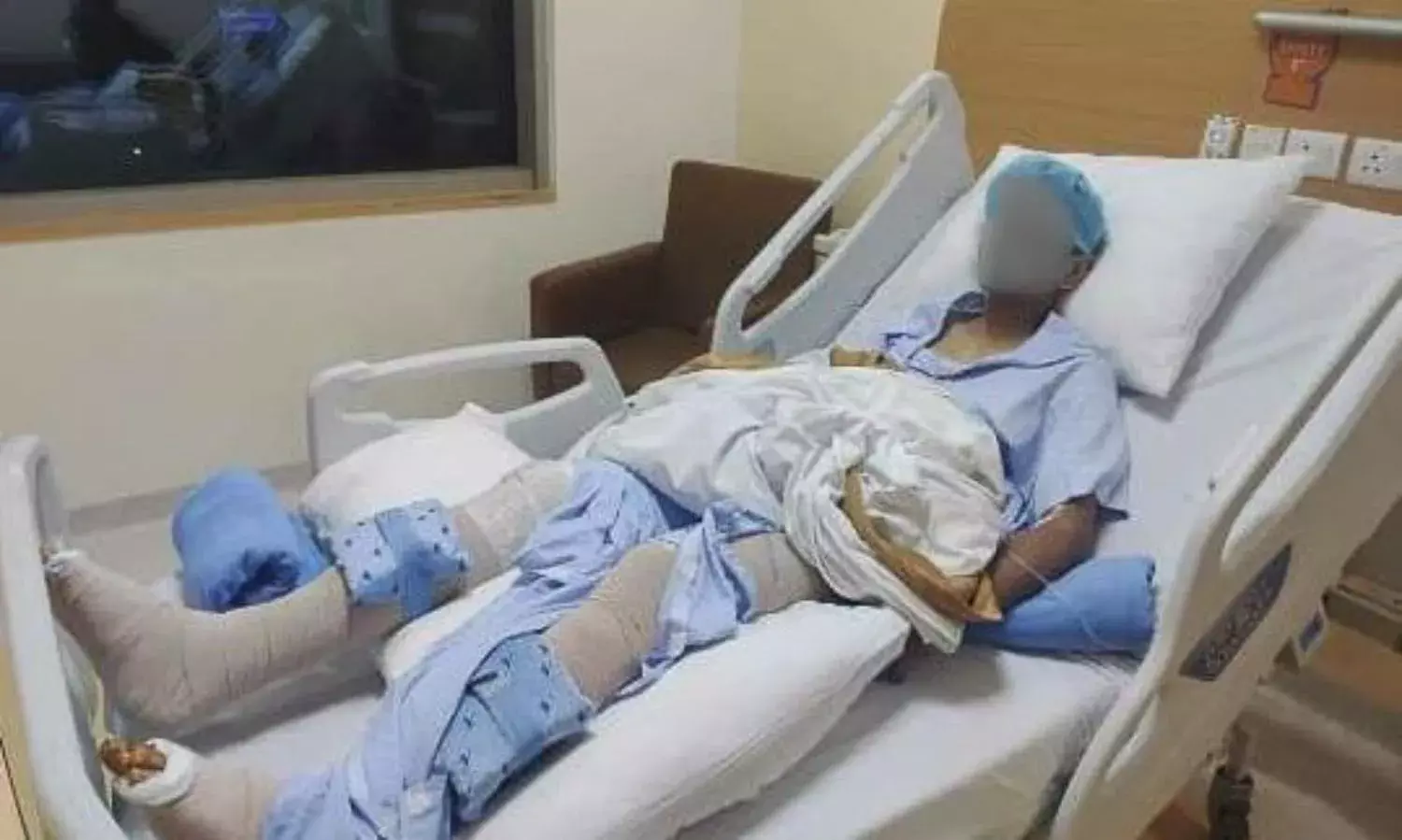 A Jamia Student With Both Legs Smashed A Jamia Student With Both Legs Smashed