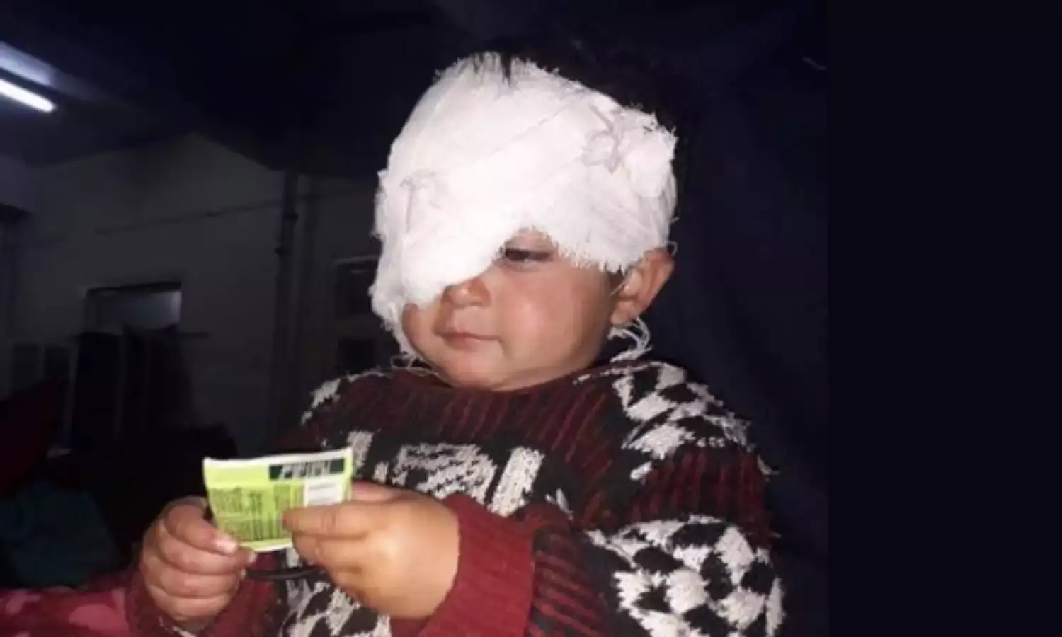 18 Month Old Hiba Jan, Kashmirs Youngest Pellet Victim