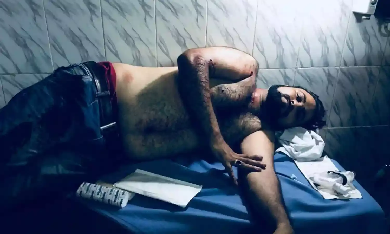 Dr Kafeel Khans Brother Shot in Gorakhpur, Condition Very Serious