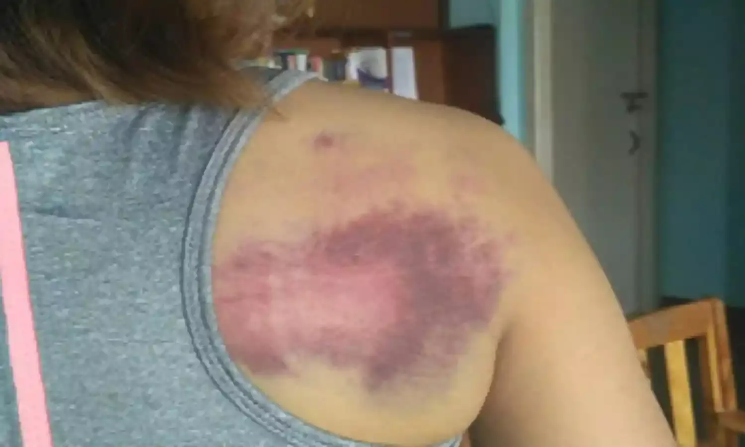 Assam Cops Attack Women Scribes, Journalists Demand Immediate Action