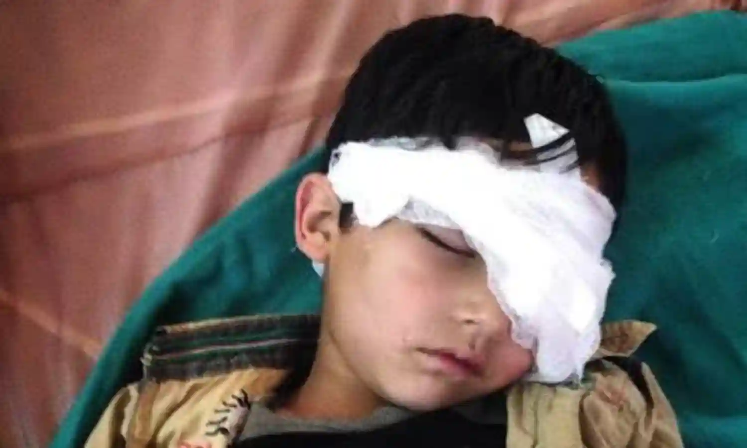 Amnesty Postcard Campaign Against Pellet Guns In Kashmir Amnesty Postcard Campaign Against Pellet Guns In Kashmir